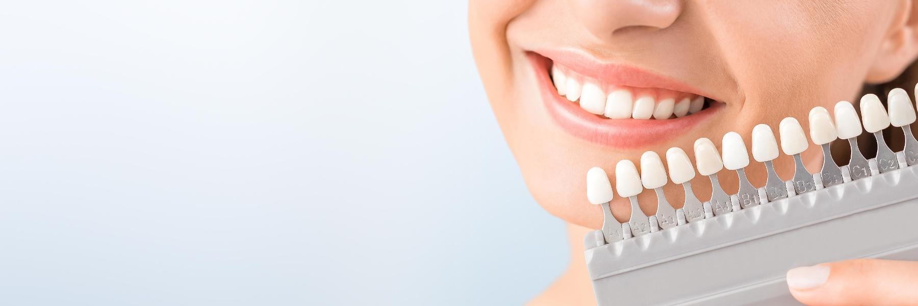 Teeth Whitening | Dentist